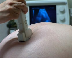 Luxora AR ultrasound tech testing pregnant woman